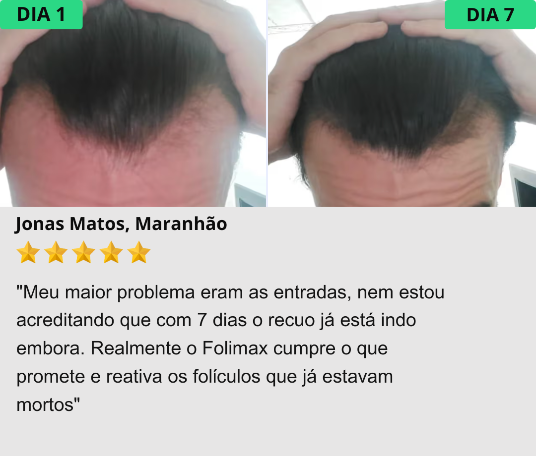 Prova Social 2