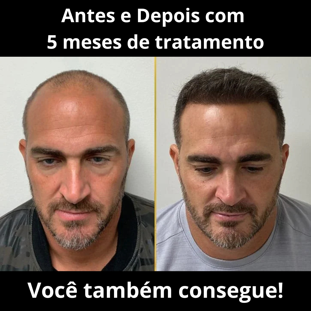 Depoimento 1